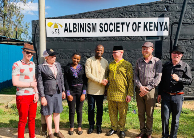 Albinism Society of Kenya
